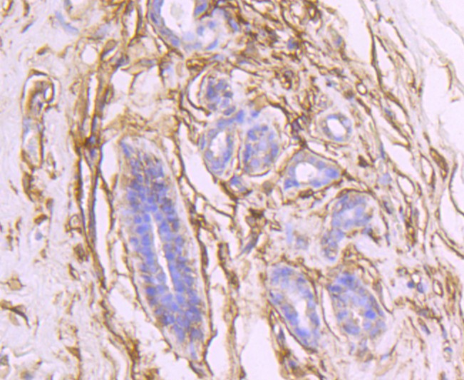 Immunohistochemical analysis of paraffin-embedded human uterus tissue using anti-CD73 antibody. The section was pre-treated using heat mediated antigen retrieval with Tris-EDTA buffer (pH 8.0-8.4) for 20 minutes.The tissues were blocked in 5% BSA for 30 minutes at room temperature, washed with ddH2O and PBS, and then probed with the primary antibody (ET1703-41, 1/50) for 30 minutes at room temperature. The detection was performed using an HRP conjugated compact polymer system. DAB was used as the chromogen. Tissues were counterstained with hematoxylin and mounted with DPX.