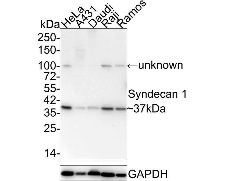 Western blot analysis of Syndecan 1 on different lysates. Proteins were transferred to a PVDF membrane and blocked with 5% BSA in PBS for 1 hour at room temperature. The primary antibody (ET1703-42, 1/500) was used in 5% BSA at room temperature for 2 hours. Goat Anti-Rabbit IgG - HRP Secondary Antibody (HA1001) at 1:200,000 dilution was used for 1 hour at room temperature.<br />
Positive control: <br />
Lane 1: Human placenta tissue lysate<br />
Lane 2: NIH/3T3 cell lysate