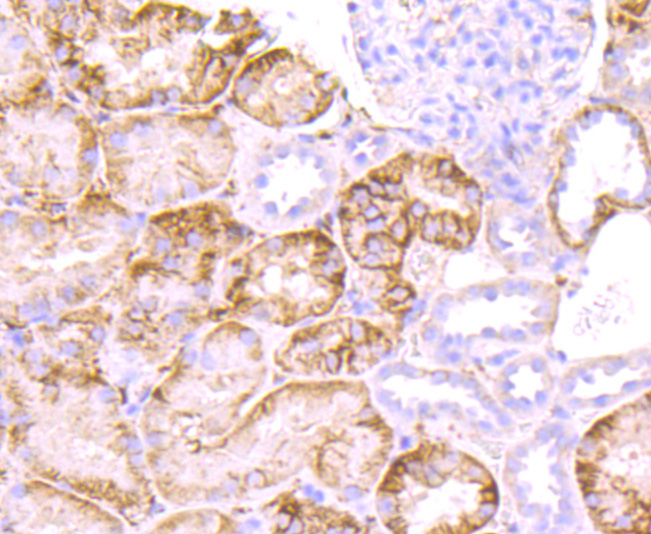 ICC staining of Syndecan 1 in Hela cells (red). Formalin fixed cells were permeabilized with 0.1% Triton X-100 in TBS for 10 minutes at room temperature and blocked with 10% negative goat serum for 15 minutes at room temperature. Cells were probed with the primary antibody (ET1703-42, 1/50) for 1 hour at room temperature, washed with PBS. Alexa Fluor®594 conjugate-Goat anti-Rabbit IgG was used as the secondary antibody at 1/1,000 dilution. The nuclear counter stain is DAPI (blue).