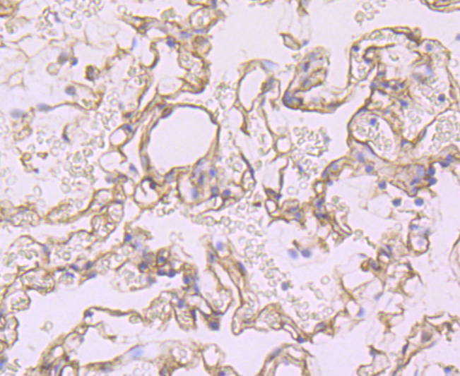 ICC staining of Syndecan 1 in HepG2 cells (red). Formalin fixed cells were permeabilized with 0.1% Triton X-100 in TBS for 10 minutes at room temperature and blocked with 10% negative goat serum for 15 minutes at room temperature. Cells were probed with the primary antibody (ET1703-42, 1/50) for 1 hour at room temperature, washed with PBS. Alexa Fluor®594 conjugate-Goat anti-Rabbit IgG was used as the secondary antibody at 1/1,000 dilution. The nuclear counter stain is DAPI (blue).