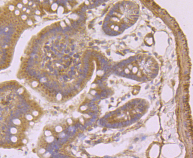Immunohistochemical analysis of paraffin-embedded human tonsil tissue using anti-Syndecan 1 antibody. The section was pre-treated using heat mediated antigen retrieval with Tris-EDTA buffer (pH 9.0) for 20 minutes.The tissues were blocked in 5% BSA for 30 minutes at room temperature, washed with ddH2O and PBS, and then probed with the primary antibody (ET1703-42, 1/50) for 30 minutes at room temperature. The detection was performed using an HRP conjugated compact polymer system. DAB was used as the chromogen. Tissues were counterstained with hematoxylin and mounted with DPX.