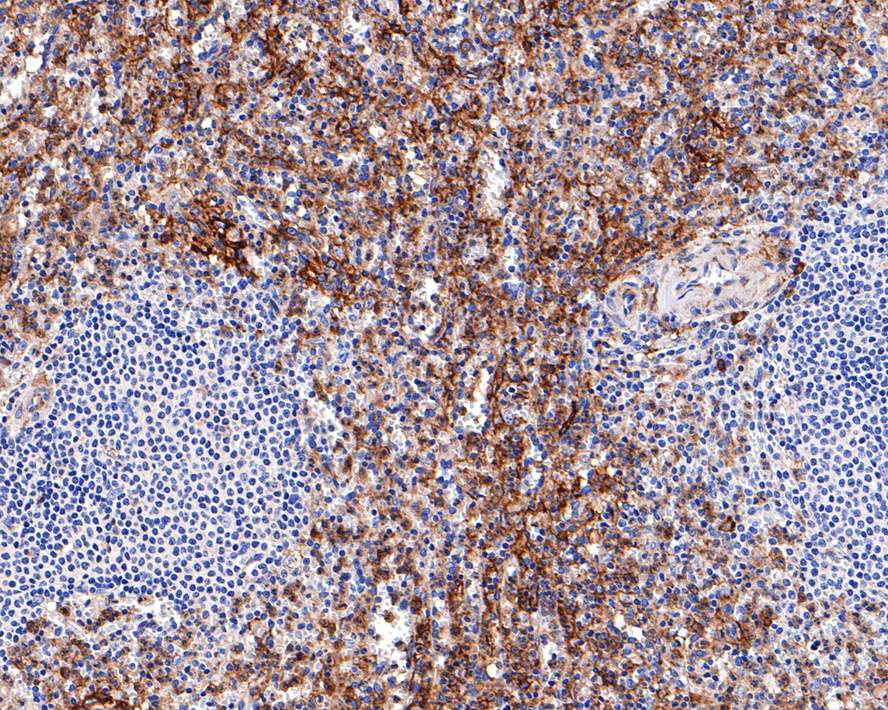 Immunohistochemical analysis of paraffin-embedded human spleen tissue with Rabbit anti-CD32 antibody (ET1703-43) at 1/400 dilution.<br />
<br />
The section was pre-treated using heat mediated antigen retrieval with Tris-EDTA buffer (pH 9.0) for 20 minutes. The tissues were blocked in 1% BSA for 20 minutes at room temperature, washed with ddH2O and PBS, and then probed with the primary antibody (ET1703-43) at 1/400 dilution for 1 hour at room temperature. The detection was performed using an HRP conjugated compact polymer system. DAB was used as the chromogen. Tissues were counterstained with hematoxylin and mounted with DPX.