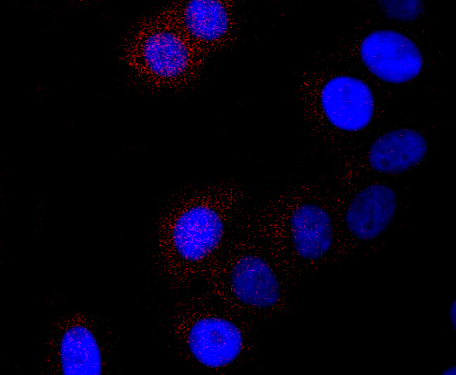ICC staining of Cathepsin L/V/K/H in HepG2 cells (red). Formalin fixed cells were permeabilized with 0.1% Triton X-100 in TBS for 10 minutes at room temperature and blocked with 1% Blocker BSA for 15 minutes at room temperature. Cells were probed with the primary antibody (ET1703-44, 1/50) for 1 hour at room temperature, washed with PBS. Alexa Fluor®594 Goat anti-Rabbit IgG was used as the secondary antibody at 1/1,000 dilution. The nuclear counter stain is DAPI (blue).