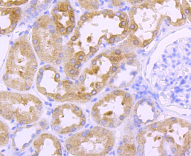 Immunohistochemical analysis of paraffin-embedded human kidney tissue using anti-Cathepsin L/V/K/H antibody. The section was pre-treated using heat mediated antigen retrieval with Tris-EDTA buffer (pH 8.0-8.4) for 20 minutes.The tissues were blocked in 5% BSA for 30 minutes at room temperature, washed with ddH2O and PBS, and then probed with the primary antibody (ET1703-44, 1/50) for 30 minutes at room temperature. The detection was performed using an HRP conjugated compact polymer system. DAB was used as the chromogen. Tissues were counterstained with hematoxylin and mounted with DPX.