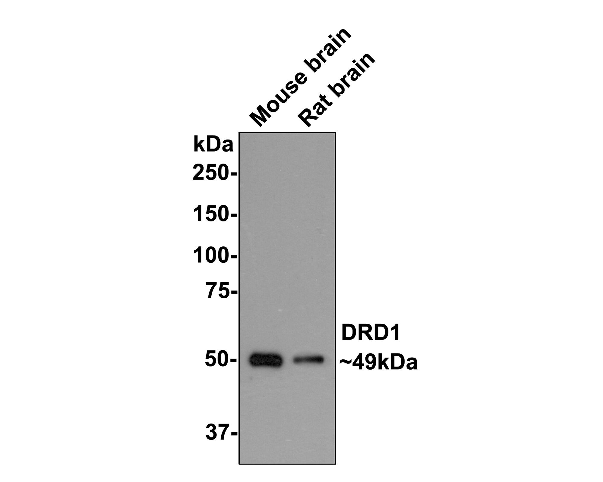 ICC staining of DRD1 in 293T cells (red). Formalin fixed cells were permeabilized with 0.1% Triton X-100 in TBS for 10 minutes at room temperature and blocked with 10% negative goat serum for 15 minutes at room temperature. Cells were probed with the primary antibody (ET1703-45, 1/50) for 1 hour at room temperature, washed with PBS. Alexa Fluor®594 conjugate-Goat anti-Rabbit IgG was used as the secondary antibody at 1/1,000 dilution. The nuclear counter stain is DAPI (blue).