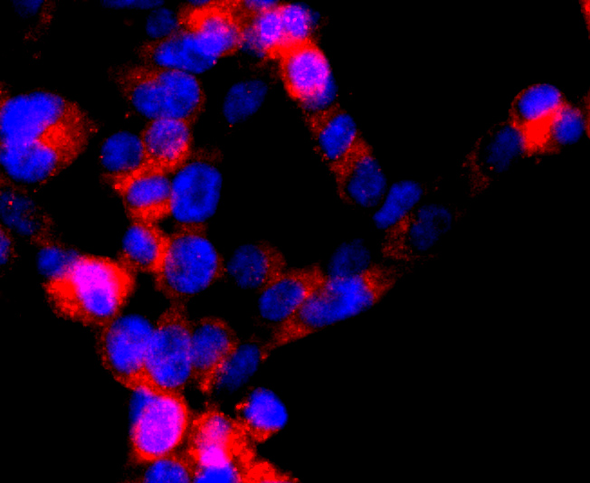 ICC staining of DRD1 in N2A cells (red). Formalin fixed cells were permeabilized with 0.1% Triton X-100 in TBS for 10 minutes at room temperature and blocked with 10% negative goat serum for 15 minutes at room temperature. Cells were probed with the primary antibody (ET1703-45, 1/50) for 1 hour at room temperature, washed with PBS. Alexa Fluor®594 conjugate-Goat anti-Rabbit IgG was used as the secondary antibody at 1/1,000 dilution. The nuclear counter stain is DAPI (blue).