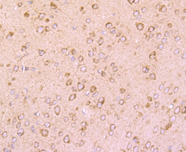 Immunohistochemical analysis of paraffin-embedded rat brain tissue using anti-DRD1 antibody. The section was pre-treated using heat mediated antigen retrieval with Tris-EDTA buffer (pH 9.0) for 20 minutes.The tissues were blocked in 1% BSA for 30 minutes at room temperature, washed with ddH2O and PBS, and then probed with the primary antibody (ET1703-45, 1/50) for 30 minutes at room temperature. The detection was performed using an HRP conjugated compact polymer system. DAB was used as the chromogen. Tissues were counterstained with hematoxylin and mounted with DPX.