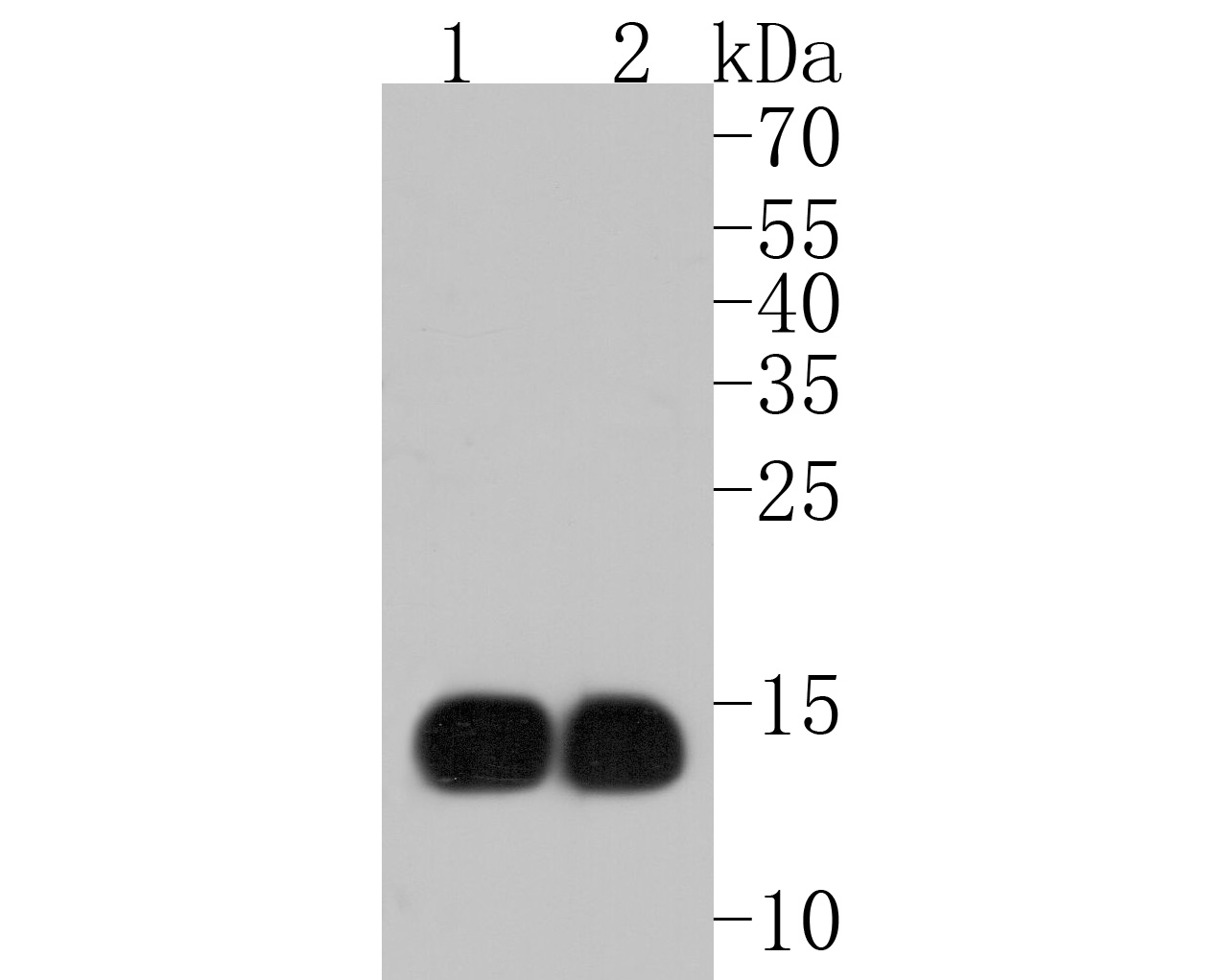 Western blot analysis of Hemoglobin subunit gamma 1and2 on different lysates. Proteins were transferred to a PVDF membrane and blocked with 5% BSA in PBS for 1 hour at room temperature. The primary antibody (ET1703-46, 1/500) was used in 5% BSA at room temperature for 2 hours. Goat Anti-Rabbit IgG - HRP Secondary Antibody (HA1001) at 1:5,000 dilution was used for 1 hour at room temperature.<br />
Positive control: <br />
Lane 1: human placenta tissue lysate<br />
Lane 2: human brain tissue lysate