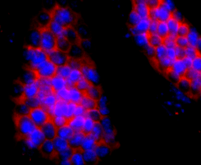 ICC staining of Hemoglobin subunit gamma 1and2 in D3 cells (red). Formalin fixed cells were permeabilized with 0.1% Triton X-100 in TBS for 10 minutes at room temperature and blocked with 1% Blocker BSA for 15 minutes at room temperature. Cells were probed with the primary antibody (ET1703-46, 1/50) for 1 hour at room temperature, washed with PBS. Alexa Fluor®594 Goat anti-Rabbit IgG was used as the secondary antibody at 1/1,000 dilution. The nuclear counter stain is DAPI (blue).