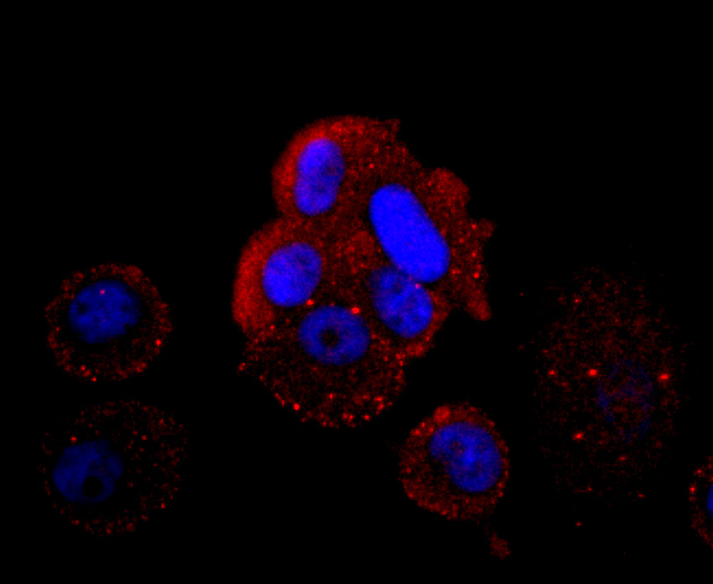 ICC staining of Hemoglobin subunit gamma 1and2 in MCF-7 cells (red). Formalin fixed cells were permeabilized with 0.1% Triton X-100 in TBS for 10 minutes at room temperature and blocked with 1% Blocker BSA for 15 minutes at room temperature. Cells were probed with the primary antibody (ET1703-46, 1/50) for 1 hour at room temperature, washed with PBS. Alexa Fluor®594 Goat anti-Rabbit IgG was used as the secondary antibody at 1/1,000 dilution. The nuclear counter stain is DAPI (blue).