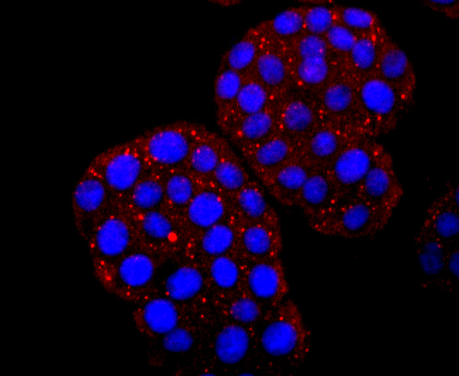 ICC staining of Hemoglobin subunit gamma 1and2 in PC-12 cells (red). Formalin fixed cells were permeabilized with 0.1% Triton X-100 in TBS for 10 minutes at room temperature and blocked with 1% Blocker BSA for 15 minutes at room temperature. Cells were probed with the primary antibody (ET1703-46, 1/50) for 1 hour at room temperature, washed with PBS. Alexa Fluor®594 Goat anti-Rabbit IgG was used as the secondary antibody at 1/1,000 dilution. The nuclear counter stain is DAPI (blue).