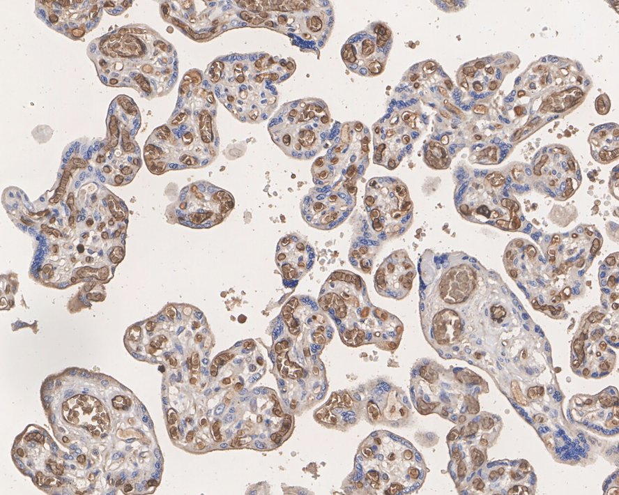 Immunohistochemical analysis of paraffin-embedded human tonsil tissue using anti-Hemoglobin subunit gamma 1and2 antibody. The section was pre-treated using heat mediated antigen retrieval with Tris-EDTA buffer (pH 8.0-8.4) for 20 minutes.The tissues were blocked in 5% BSA for 30 minutes at room temperature, washed with ddH2O and PBS, and then probed with the primary antibody (ET1703-46, 1/50) for 30 minutes at room temperature. The detection was performed using an HRP conjugated compact polymer system. DAB was used as the chromogen. Tissues were counterstained with hematoxylin and mounted with DPX.