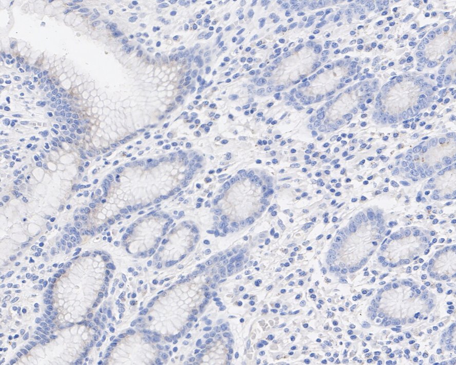 Immunohistochemical analysis of paraffin-embedded human spleen tissue using anti-Hemoglobin subunit gamma 1and2 antibody. The section was pre-treated using heat mediated antigen retrieval with Tris-EDTA buffer (pH 8.0-8.4) for 20 minutes.The tissues were blocked in 5% BSA for 30 minutes at room temperature, washed with ddH2O and PBS, and then probed with the primary antibody (ET1703-46, 1/50) for 30 minutes at room temperature. The detection was performed using an HRP conjugated compact polymer system. DAB was used as the chromogen. Tissues were counterstained with hematoxylin and mounted with DPX.