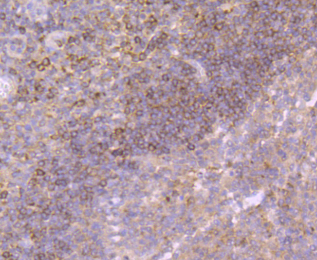 Immunohistochemical analysis of paraffin-embedded human tonsil tissue using anti-Growth Hormone antibody. The section was pre-treated using heat mediated antigen retrieval with Tris-EDTA buffer (pH 9.0) for 20 minutes.The tissues were blocked in 1% BSA for 30 minutes at room temperature, washed with ddH2O and PBS, and then probed with the primary antibody (ET1703-47, 1/50) for 30 minutes at room temperature. The detection was performed using an HRP conjugated compact polymer system. DAB was used as the chromogen. Tissues were counterstained with hematoxylin and mounted with DPX.