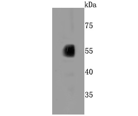 Western blot analysis of CYP2E1 on human liver tissue lysates. Proteins were transferred to a PVDF membrane and blocked with 5% BSA in PBS for 1 hour at room temperature. The primary antibody (ET1703-48, 1/500) was used in 5% BSA at room temperature for 2 hours. Goat Anti-Rabbit IgG - HRP Secondary Antibody (HA1001) at 1:5,000 dilution was used for 1 hour at room temperature.