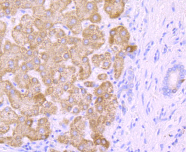 Immunohistochemical analysis of paraffin-embedded human liver tissue using anti-CYP2E1 antibody. The section was pre-treated using heat mediated antigen retrieval with Tris-EDTA buffer (pH 8.0-8.4) for 20 minutes.The tissues were blocked in 5% BSA for 30 minutes at room temperature, washed with ddH2O and PBS, and then probed with the primary antibody (ET1703-48, 1/50) for 30 minutes at room temperature. The detection was performed using an HRP conjugated compact polymer system. DAB was used as the chromogen. Tissues were counterstained with hematoxylin and mounted with DPX.