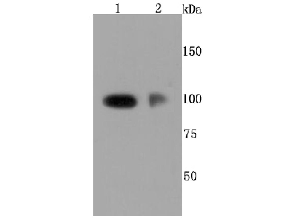 Western blot analysis of CD62P on different lysates. Proteins were transferred to a PVDF membrane and blocked with 5% BSA in PBS for 1 hour at room temperature. The primary antibody (ET1703-49, 1/500) was used in 5% BSA at room temperature for 2 hours. Goat Anti-Rabbit IgG - HRP Secondary Antibody (HA1001) at 1:200,000 dilution was used for 1 hour at room temperature.<br />
Positive control: <br />
Lane 1: HUVEC cell lysate<br />
Lane 2: Human placenta tissue lysate<br />
<br />
Predicted band size: 91 kDa<br />
Observed band size: 100 kDa