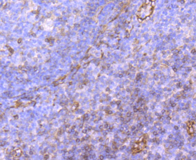 Immunohistochemical analysis of paraffin-embedded human tonsil tissue using anti-CD62P antibody. The section was pre-treated using heat mediated antigen retrieval with Tris-EDTA buffer (pH 9.0) for 20 minutes.The tissues were blocked in 1% BSA for 30 minutes at room temperature, washed with ddH2O and PBS, and then probed with the primary antibody (ET1703-49, 1/50) for 30 minutes at room temperature. The detection was performed using an HRP conjugated compact polymer system. DAB was used as the chromogen. Tissues were counterstained with hematoxylin and mounted with DPX.
