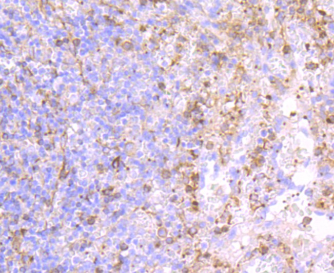 Immunohistochemical analysis of paraffin-embedded human spleen tissue using anti-CD62P antibody. The section was pre-treated using heat mediated antigen retrieval with Tris-EDTA buffer (pH 9.0) for 20 minutes.The tissues were blocked in 1% BSA for 30 minutes at room temperature, washed with ddH2O and PBS, and then probed with the primary antibody (ET1703-49, 1/50) for 30 minutes at room temperature. The detection was performed using an HRP conjugated compact polymer system. DAB was used as the chromogen. Tissues were counterstained with hematoxylin and mounted with DPX.