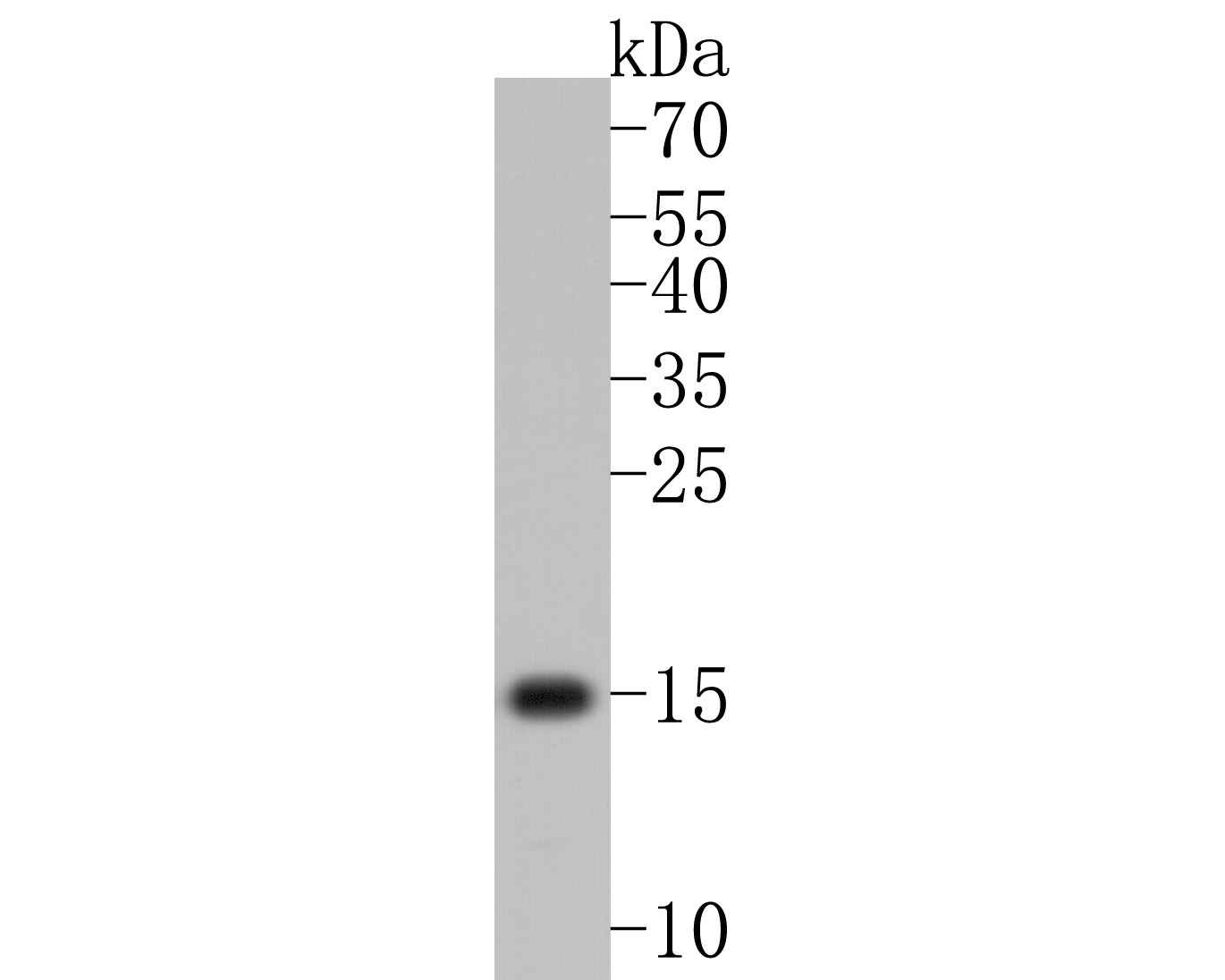 Western blot analysis of VAMP2 on Jurkat cell lysates. Proteins were transferred to a PVDF membrane and blocked with 5% BSA in PBS for 1 hour at room temperature. The primary antibody (ET1703-50, 1/500) was used in 5% BSA at room temperature for 2 hours. Goat Anti-Rabbit IgG - HRP Secondary Antibody (HA1001) at 1:200,000 dilution was used for 1 hour at room temperature.