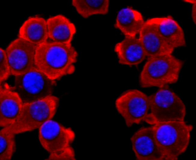 ICC staining of VAMP2 in N2A cells (red). Formalin fixed cells were permeabilized with 0.1% Triton X-100 in TBS for 10 minutes at room temperature and blocked with 10% negative goat serum for 15 minutes at room temperature. Cells were probed with the primary antibody (ET1703-50, 1/50) for 1 hour at room temperature, washed with PBS. Alexa Fluor®594 conjugate-Goat anti-Rabbit IgG was used as the secondary antibody at 1/1,000 dilution. The nuclear counter stain is DAPI (blue).