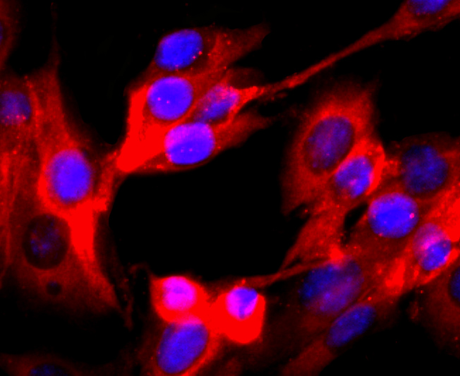ICC staining of VAMP2 in SHG-44 cells (red). Formalin fixed cells were permeabilized with 0.1% Triton X-100 in TBS for 10 minutes at room temperature and blocked with 10% negative goat serum for 15 minutes at room temperature. Cells were probed with the primary antibody (ET1703-50, 1/50) for 1 hour at room temperature, washed with PBS. Alexa Fluor®594 conjugate-Goat anti-Rabbit IgG was used as the secondary antibody at 1/1,000 dilution. The nuclear counter stain is DAPI (blue).