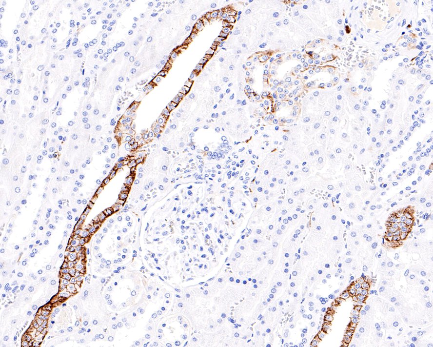 Immunohistochemical analysis of paraffin-embedded human kidney tissue with Rabbit anti-L1CAM antibody (ET1703-51) at 1/200 dilution.<br />
<br />
The section was pre-treated using heat mediated antigen retrieval with Tris-EDTA buffer (pH 9.0) for 20 minutes. The tissues were blocked in 1% BSA for 20 minutes at room temperature, washed with ddH2O and PBS, and then probed with the primary antibody (ET1703-51) at 1/200 dilution for 1 hour at room temperature. The detection was performed using an HRP conjugated compact polymer system. DAB was used as the chromogen. Tissues were counterstained with hematoxylin and mounted with DPX.