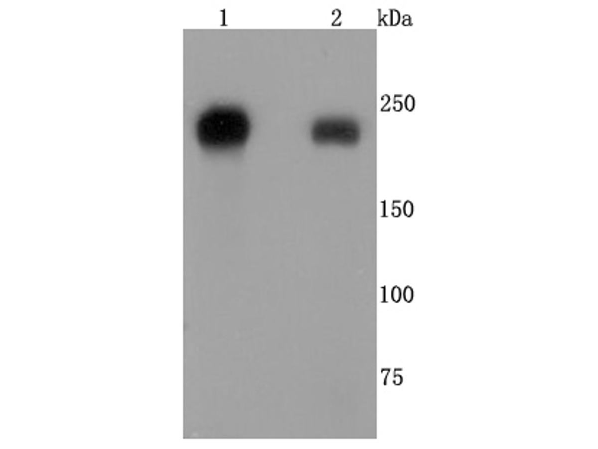 Western blot analysis of Integrin beta 4 on different lysates. Proteins were transferred to a PVDF membrane and blocked with 5% BSA in PBS for 1 hour at room temperature. The primary antibody (ET1703-52, 1/500) was used in 5% BSA at room temperature for 2 hours. Goat Anti-Rabbit IgG - HRP Secondary Antibody (HA1001) at 1:200,000 dilution was used for 1 hour at room temperature.<br />
Positive control: <br />
Lane 1: A431 cell lysate<br />
Lane 2: A549 cell lysate