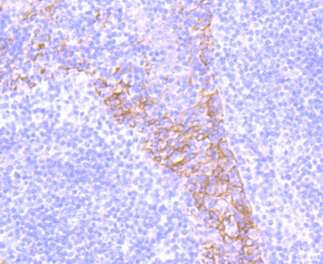 Immunohistochemical analysis of paraffin-embedded human tonsil tissue using anti-Integrin beta 4 antibody. The section was pre-treated using heat mediated antigen retrieval with Tris-EDTA buffer (pH 9.0) for 20 minutes.The tissues were blocked in 1% BSA for 30 minutes at room temperature, washed with ddH2O and PBS, and then probed with the primary antibody (ET1703-52, 1/50) for 30 minutes at room temperature. The detection was performed using an HRP conjugated compact polymer system. DAB was used as the chromogen. Tissues were counterstained with hematoxylin and mounted with DPX.
