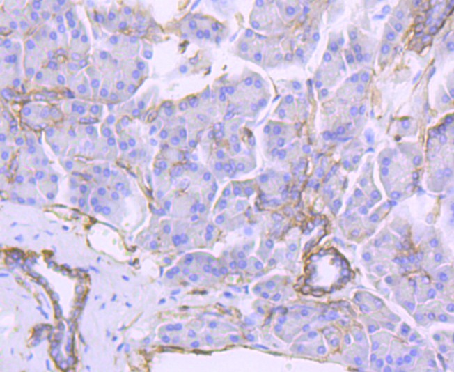 Immunohistochemical analysis of paraffin-embedded human pancreas tissue using anti-Integrin beta 4 antibody. The section was pre-treated using heat mediated antigen retrieval with Tris-EDTA buffer (pH 9.0) for 20 minutes.The tissues were blocked in 1% BSA for 30 minutes at room temperature, washed with ddH2O and PBS, and then probed with the primary antibody (ET1703-52, 1/50) for 30 minutes at room temperature. The detection was performed using an HRP conjugated compact polymer system. DAB was used as the chromogen. Tissues were counterstained with hematoxylin and mounted with DPX.
