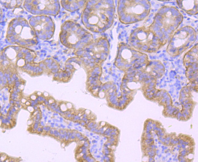 Immunohistochemical analysis of paraffin-embedded mouse colon tissue using anti-Integrin beta 4 antibody. The section was pre-treated using heat mediated antigen retrieval with Tris-EDTA buffer (pH 9.0) for 20 minutes.The tissues were blocked in 1% BSA for 30 minutes at room temperature, washed with ddH2O and PBS, and then probed with the primary antibody (ET1703-52, 1/50) for 30 minutes at room temperature. The detection was performed using an HRP conjugated compact polymer system. DAB was used as the chromogen. Tissues were counterstained with hematoxylin and mounted with DPX.