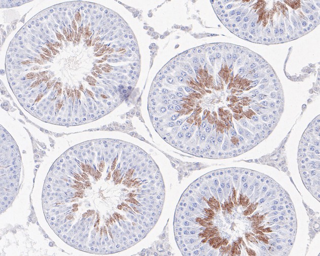 Immunohistochemical analysis of paraffin-embedded rat testis tissue using anti-CaMKII alpha antibody. The section was pre-treated using heat mediated antigen retrieval with Tris-EDTA buffer (pH 8.0-8.4) for 20 minutes.The tissues were blocked in 5% BSA for 30 minutes at room temperature, washed with ddH2O and PBS, and then probed with the primary antibody (ET1703-54, 1/50) for 30 minutes at room temperature. The detection was performed using an HRP conjugated compact polymer system. DAB was used as the chromogen. Tissues were counterstained with hematoxylin and mounted with DPX.