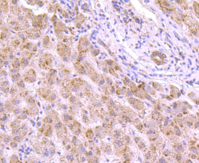 Immunohistochemical analysis of paraffin-embedded human liver tissue using anti-VCP antibody. The section was pre-treated using heat mediated antigen retrieval with Tris-EDTA buffer (pH 8.0-8.4) for 20 minutes.The tissues were blocked in 5% BSA for 30 minutes at room temperature, washed with ddH2O and PBS, and then probed with the primary antibody (ET1703-56, 1/50) for 30 minutes at room temperature. The detection was performed using an HRP conjugated compact polymer system. DAB was used as the chromogen. Tissues were counterstained with hematoxylin and mounted with DPX.