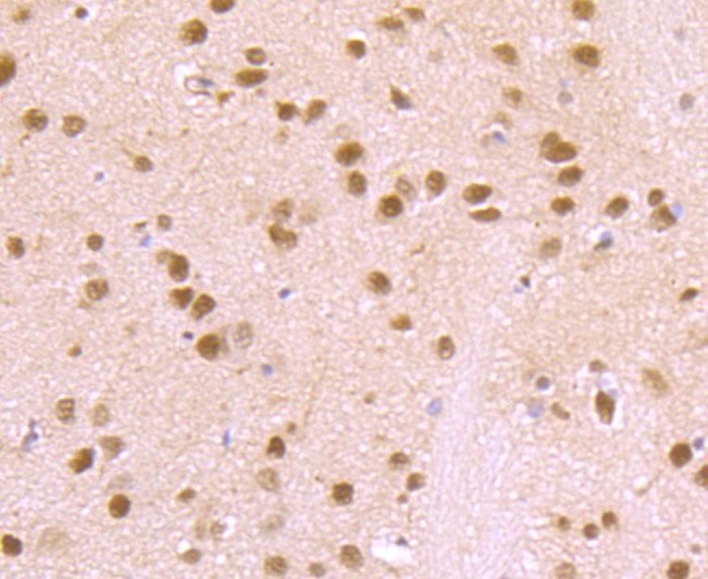 Immunohistochemical analysis of paraffin-embedded rat brain tissue using anti-VCP antibody. The section was pre-treated using heat mediated antigen retrieval with Tris-EDTA buffer (pH 8.0-8.4) for 20 minutes.The tissues were blocked in 5% BSA for 30 minutes at room temperature, washed with ddH2O and PBS, and then probed with the primary antibody (ET1703-56, 1/50) for 30 minutes at room temperature. The detection was performed using an HRP conjugated compact polymer system. DAB was used as the chromogen. Tissues were counterstained with hematoxylin and mounted with DPX.