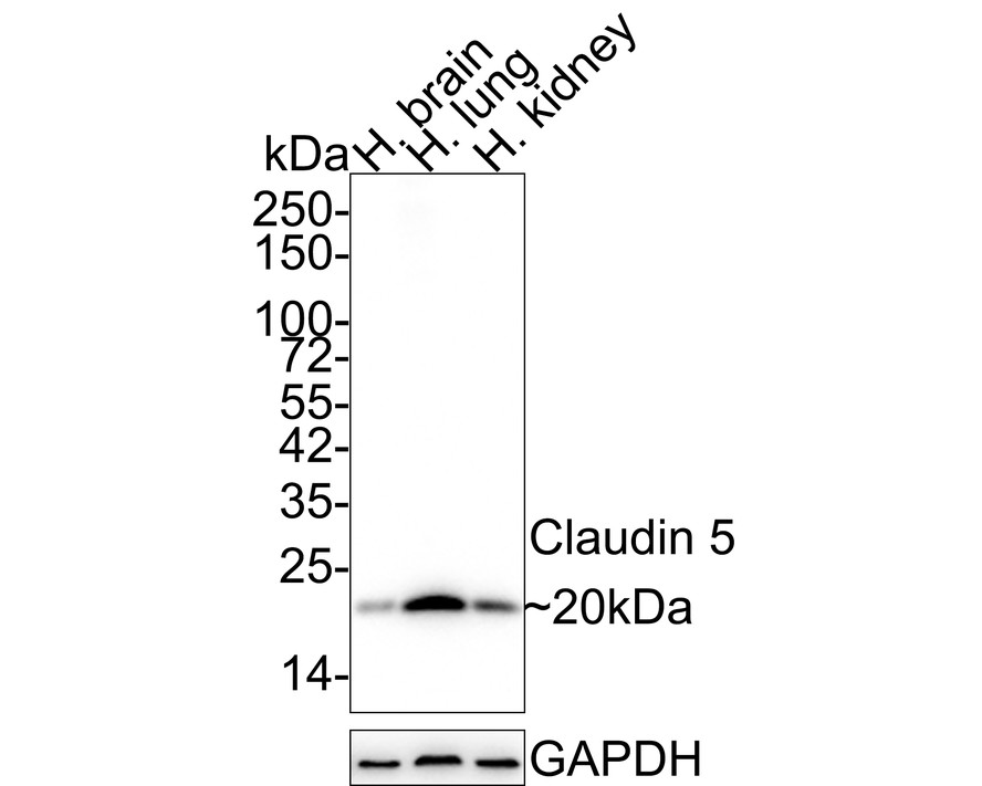 Western blot analysis of Claudin 5 on human lung tissue lysates. Proteins were transferred to a PVDF membrane and blocked with 5% BSA in PBS for 1 hour at room temperature. The primary antibody (ET1703-58, 1/500) was used in 5% BSA at room temperature for 2 hours. Goat Anti-Rabbit IgG - HRP Secondary Antibody (HA1001) at 1:200,000 dilution was used for 1 hour at room temperature.