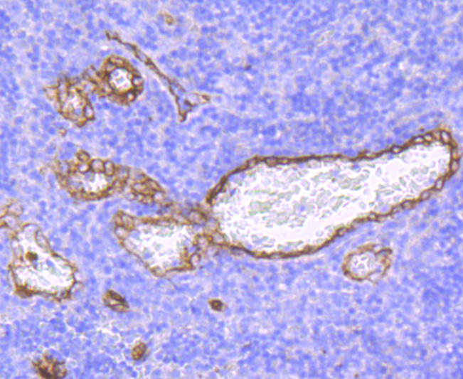 Immunohistochemical analysis of paraffin-embedded human tonsil tissue using anti-Claudin 5 antibody. The section was pre-treated using heat mediated antigen retrieval with Tris-EDTA buffer (pH 9.0) for 20 minutes.The tissues were blocked in 5% BSA for 30 minutes at room temperature, washed with ddH2O and PBS, and then probed with the primary antibody (ET1703-58, 1/50) for 30 minutes at room temperature. The detection was performed using an HRP conjugated compact polymer system. DAB was used as the chromogen. Tissues were counterstained with hematoxylin and mounted with DPX.