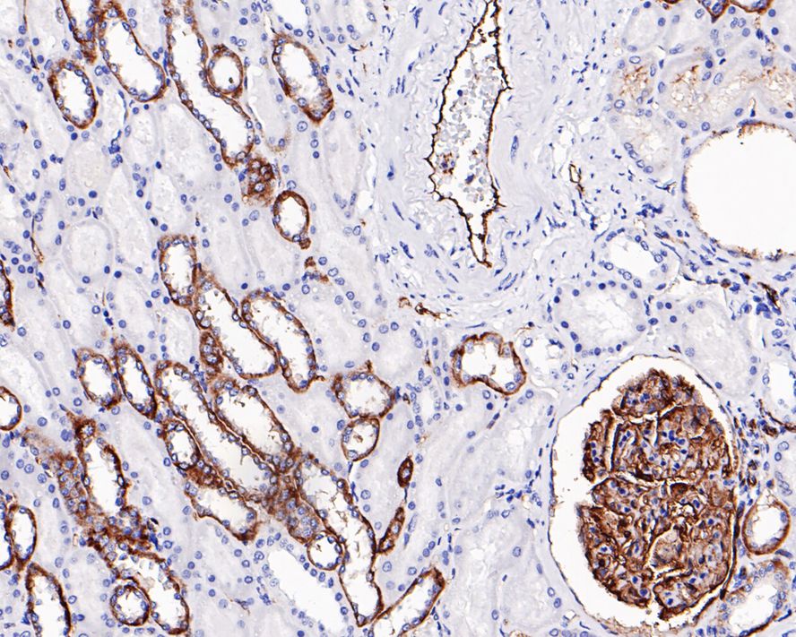 Immunohistochemical analysis of paraffin-embedded human kidney tissue with Rabbit anti-Claudin 5 antibody (ET1703-58) at 1/50 dilution.<br />
<br />
The section was pre-treated using heat mediated antigen retrieval with Tris-EDTA buffer (pH 9.0) for 20 minutes. The tissues were blocked in 1% BSA for 20 minutes at room temperature, washed with ddH2O and PBS, and then probed with the primary antibody (ET1703-58) at 1/50 dilution for 1 hour at room temperature. The detection was performed using an HRP conjugated compact polymer system. DAB was used as the chromogen. Tissues were counterstained with hematoxylin and mounted with DPX.