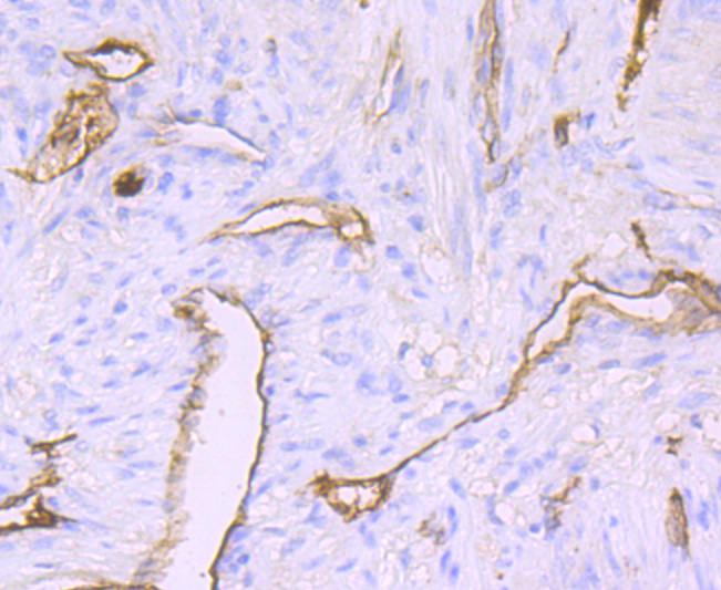 Immunohistochemical analysis of paraffin-embedded human uterus tissue using anti-Claudin 5 antibody. The section was pre-treated using heat mediated antigen retrieval with Tris-EDTA buffer (pH 9.0) for 20 minutes.The tissues were blocked in 5% BSA for 30 minutes at room temperature, washed with ddH2O and PBS, and then probed with the primary antibody (ET1703-58, 1/50) for 30 minutes at room temperature. The detection was performed using an HRP conjugated compact polymer system. DAB was used as the chromogen. Tissues were counterstained with hematoxylin and mounted with DPX.