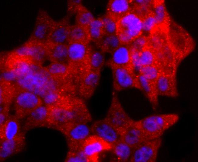 ICC staining of TIA1 in 293T cells (red). Formalin fixed cells were permeabilized with 0.1% Triton X-100 in TBS for 10 minutes at room temperature and blocked with 1% Blocker BSA for 15 minutes at room temperature. Cells were probed with the primary antibody (ET1703-59, 1/50) for 1 hour at room temperature, washed with PBS. Alexa Fluor®594 Goat anti-Rabbit IgG was used as the secondary antibody at 1/1,000 dilution. The nuclear counter stain is DAPI (blue).