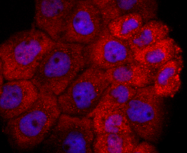 ICC staining of TIA1 in A431 cells (red). Formalin fixed cells were permeabilized with 0.1% Triton X-100 in TBS for 10 minutes at room temperature and blocked with 1% Blocker BSA for 15 minutes at room temperature. Cells were probed with the primary antibody (ET1703-59, 1/50) for 1 hour at room temperature, washed with PBS. Alexa Fluor®594 Goat anti-Rabbit IgG was used as the secondary antibody at 1/1,000 dilution. The nuclear counter stain is DAPI (blue).