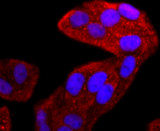 ICC staining of TIA1 in Hela cells (red). Formalin fixed cells were permeabilized with 0.1% Triton X-100 in TBS for 10 minutes at room temperature and blocked with 1% Blocker BSA for 15 minutes at room temperature. Cells were probed with the primary antibody (ET1703-59, 1/50) for 1 hour at room temperature, washed with PBS. Alexa Fluor®594 Goat anti-Rabbit IgG was used as the secondary antibody at 1/1,000 dilution. The nuclear counter stain is DAPI (blue).