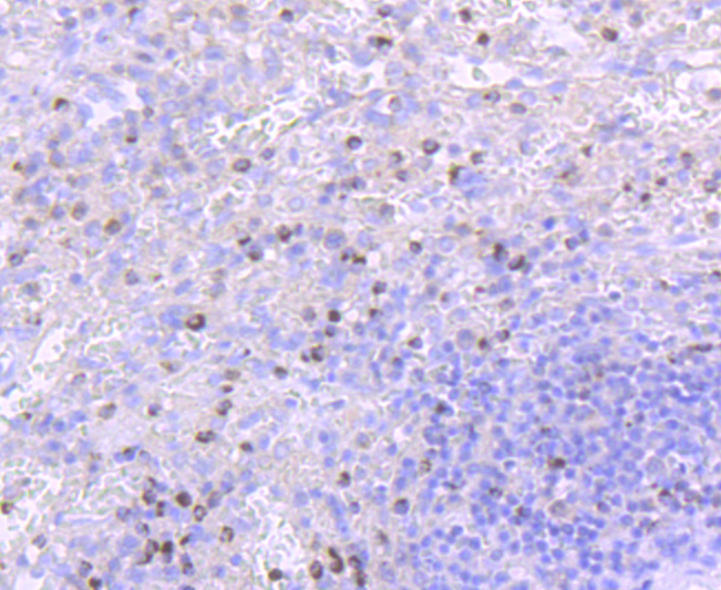 Immunohistochemical analysis of paraffin-embedded human spleen tissue using anti-TIA1 antibody. The section was pre-treated using heat mediated antigen retrieval with Tris-EDTA buffer (pH 8.0-8.4) for 20 minutes.The tissues were blocked in 5% BSA for 30 minutes at room temperature, washed with ddH2O and PBS, and then probed with the primary antibody (ET1703-59, 1/50) for 30 minutes at room temperature. The detection was performed using an HRP conjugated compact polymer system. DAB was used as the chromogen. Tissues were counterstained with hematoxylin and mounted with DPX.