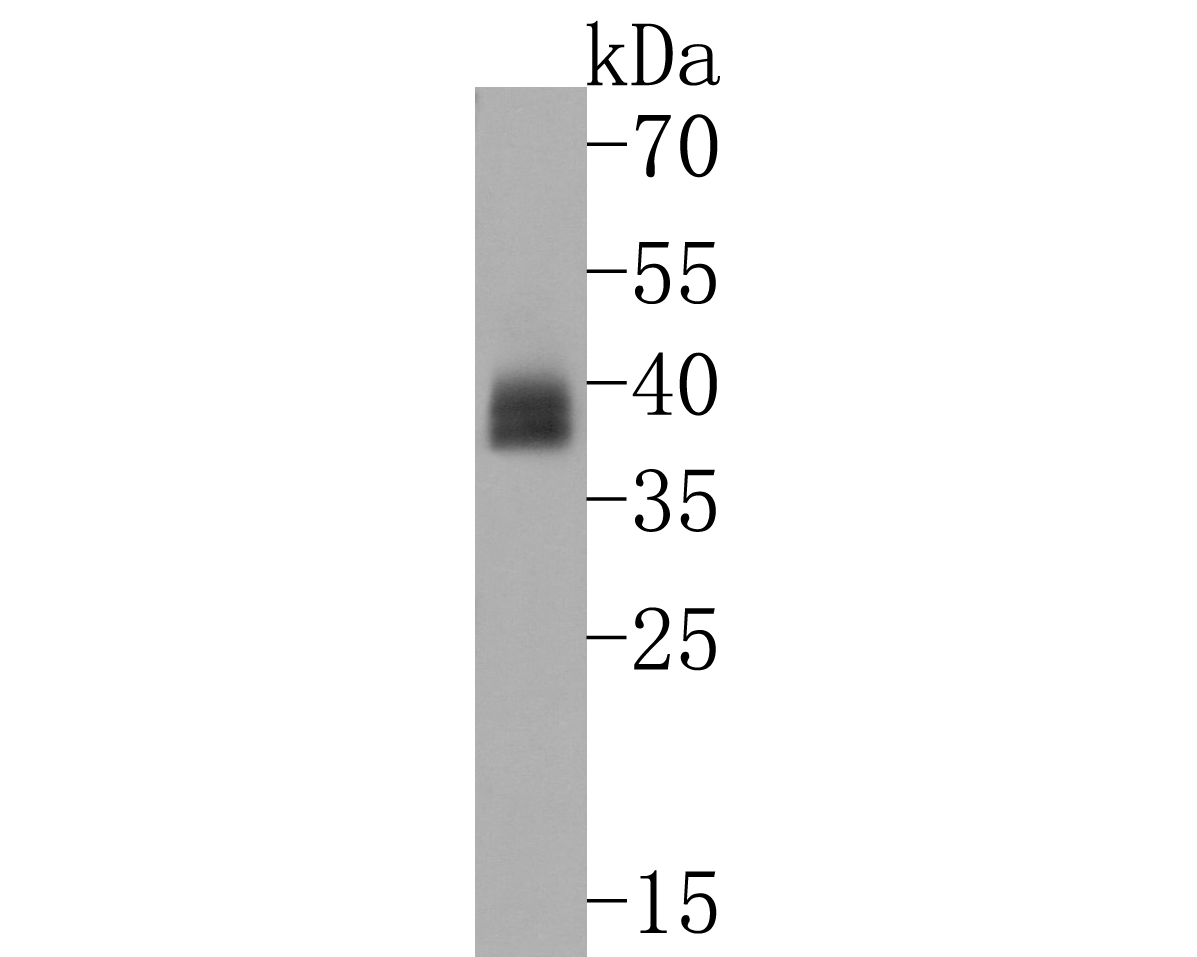 Western blot analysis of Podoplanin on human lung tissue lysates. Proteins were transferred to a PVDF membrane and blocked with 5% BSA in PBS for 1 hour at room temperature. The primary antibody (ET1703-61, 1/500) was used in 5% BSA at room temperature for 2 hours. Goat Anti-Rabbit IgG - HRP Secondary Antibody (HA1001) at 1:200,000 dilution was used for 1 hour at room temperature.