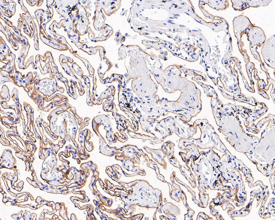 Immunohistochemical analysis of paraffin-embedded human lung tissue using anti-Podoplanin antibody. The section was pre-treated using heat mediated antigen retrieval with Tris-EDTA buffer (pH 9.0) for 20 minutes.The tissues were blocked in 1% BSA for 30 minutes at room temperature, washed with ddH2O and PBS, and then probed with the primary antibody (ET1703-61, 1/50) for 30 minutes at room temperature. The detection was performed using an HRP conjugated compact polymer system. DAB was used as the chromogen. Tissues were counterstained with hematoxylin and mounted with DPX.