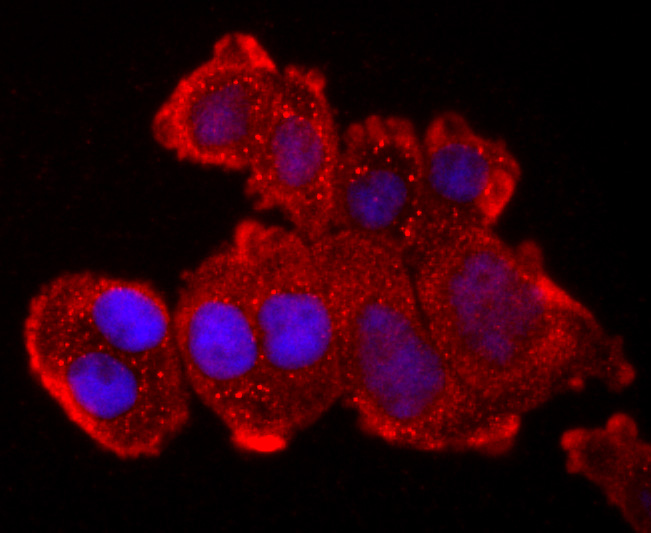 ICC staining of TNF Receptor II in MCF-7 cells (red). Formalin fixed cells were permeabilized with 0.1% Triton X-100 in TBS for 10 minutes at room temperature and blocked with 1% Blocker BSA for 15 minutes at room temperature. Cells were probed with the primary antibody (ET1703-63, 1/50) for 1 hour at room temperature, washed with PBS. Alexa Fluor®594 Goat anti-Rabbit IgG was used as the secondary antibody at 1/1,000 dilution. The nuclear counter stain is DAPI (blue).