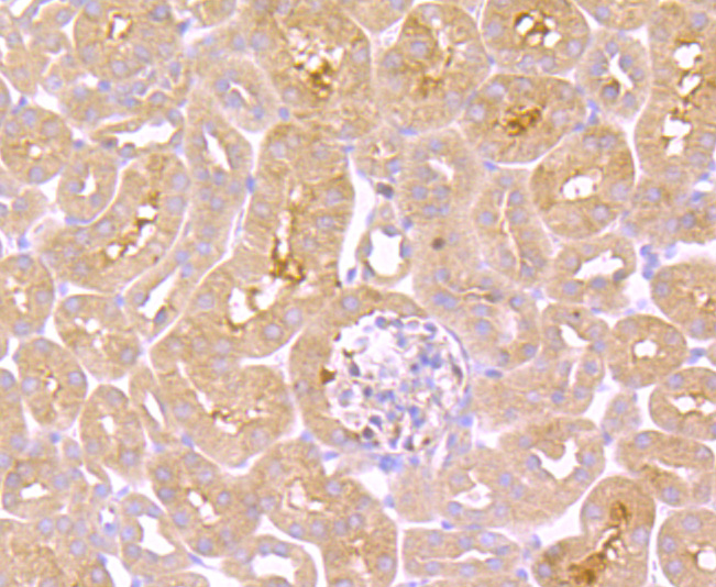 Immunohistochemical analysis of paraffin-embedded human kidney tissue using anti-TNF Receptor II antibody. The section was pre-treated using heat mediated antigen retrieval with Tris-EDTA buffer (pH 8.0-8.4) for 20 minutes.The tissues were blocked in 5% BSA for 30 minutes at room temperature, washed with ddH2O and PBS, and then probed with the primary antibody (ET1703-63, 1/50) for 30 minutes at room temperature. The detection was performed using an HRP conjugated compact polymer system. DAB was used as the chromogen. Tissues were counterstained with hematoxylin and mounted with DPX.