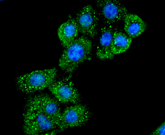 ICC staining of CD40L in NIH/3T3 cells (green). Formalin fixed cells were permeabilized with 0.1% Triton X-100 in TBS for 10 minutes at room temperature and blocked with 1% Blocker BSA for 15 minutes at room temperature. Cells were probed with the primary antibody (ET1703-64, 1/50) for 1 hour at room temperature, washed with PBS. Alexa Fluor®488 Goat anti-Rabbit IgG was used as the secondary antibody at 1/1,000 dilution. The nuclear counter stain is DAPI (blue).