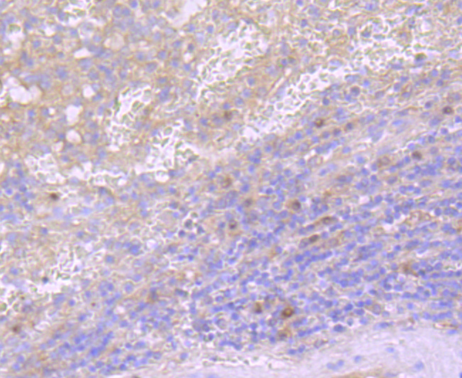 Immunohistochemical analysis of paraffin-embedded human spleen tissue using anti-CD40L antibody. The section was pre-treated using heat mediated antigen retrieval with Tris-EDTA buffer (pH 8.0-8.4) for 20 minutes.The tissues were blocked in 5% BSA for 30 minutes at room temperature, washed with ddH2O and PBS, and then probed with the primary antibody (ET1703-64, 1/50) for 30 minutes at room temperature. The detection was performed using an HRP conjugated compact polymer system. DAB was used as the chromogen. Tissues were counterstained with hematoxylin and mounted with DPX.