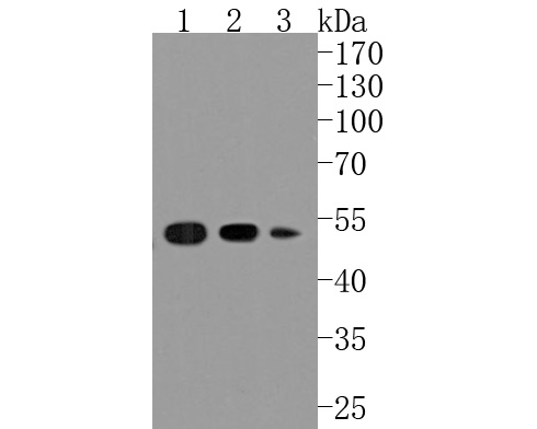 Western blot analysis of PABPN1 on different lysates. Proteins were transferred to a PVDF membrane and blocked with 5% BSA in PBS for 1 hour at room temperature. The primary antibody (ET1703-66, 1/500) was used in 5% BSA at room temperature for 2 hours. Goat Anti-Rabbit IgG - HRP Secondary Antibody (HA1001) at 1:5,000 dilution was used for 1 hour at room temperature.<br />
Positive control: <br />
Lane 1: MCF-7 cell lysate<br />
Lane 2: SH-SY5Y cell lysate<br />
Lane 3: rat skin tissue lysate