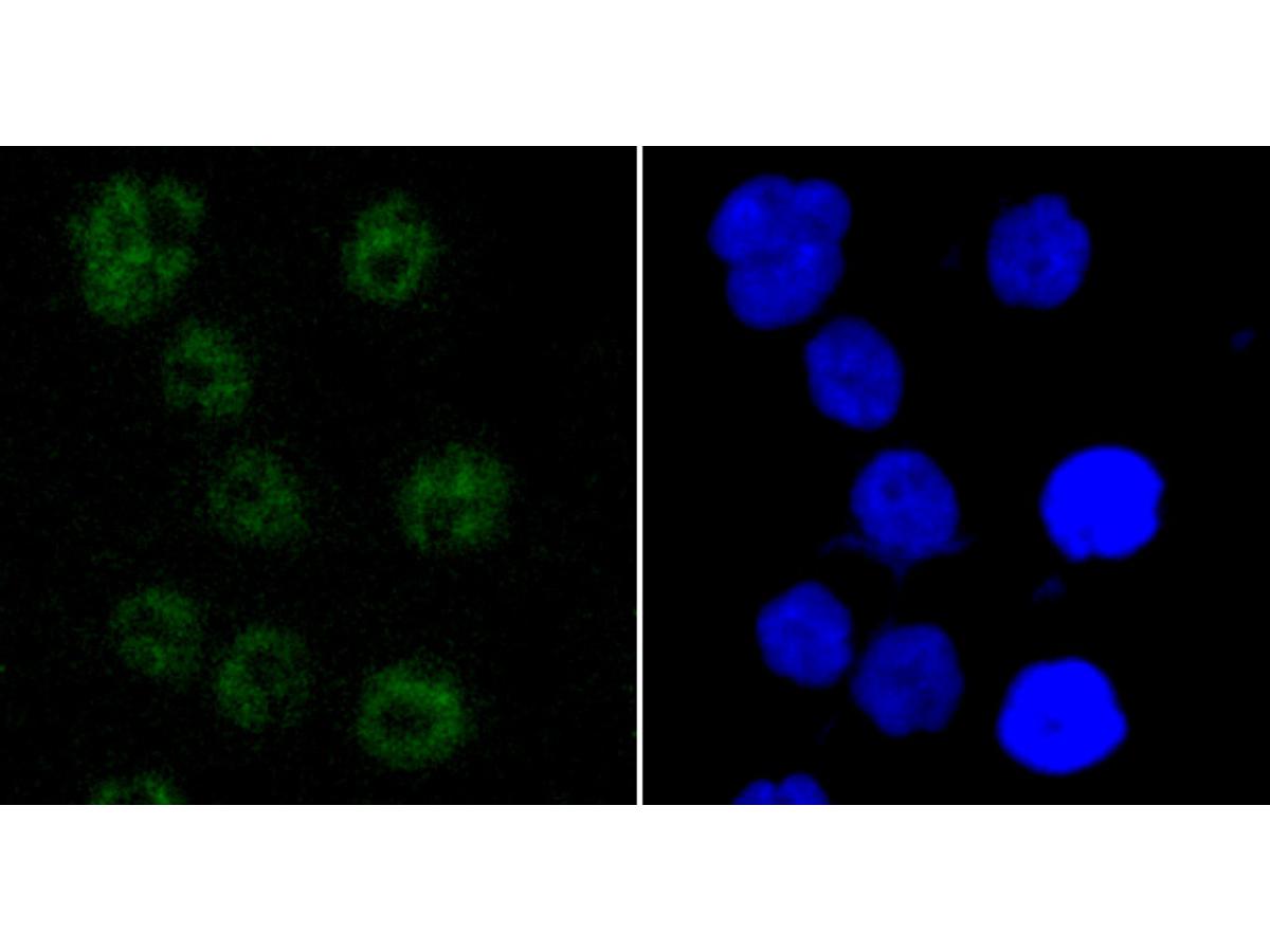 ICC staining of PABPN1 in AGS cells (green). Formalin fixed cells were permeabilized with 0.1% Triton X-100 in TBS for 10 minutes at room temperature and blocked with 1% Blocker BSA for 15 minutes at room temperature. Cells were probed with the primary antibody (ET1703-66, 1/50) for 1 hour at room temperature, washed with PBS. Alexa Fluor®488 Goat anti-Rabbit IgG was used as the secondary antibody at 1/1,000 dilution. The nuclear counter stain is DAPI (blue).